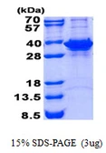 Human FN3KRP protein, His tag. GTX68740-pro