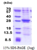 Human SIKE1 protein, His tag. GTX68753-pro