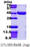 Human NPL protein, His tag. GTX68766-pro