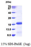 Human PDRG1 protein, His tag. GTX68769-pro