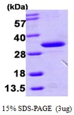Human HDHD3 protein, His tag. GTX68777-pro