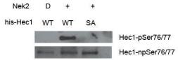 Anti-Hec1 (phospho Ser 76/77) antibody used in Western Blot (WB). GTX70015