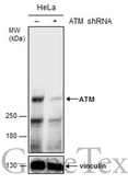 Anti-ATM antibody [2C1] used in Western Blot (WB). GTX70103