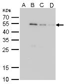 Anti-GST tag antibody [3G10] used in Western Blot (WB). GTX70195