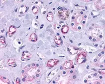Anti-Progesterone Receptor antibody [4D8] used in Immunohistochemistry (IHC). GTX70227