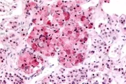 Anti-MT2 antibody used in IHC (Paraffin sections) (IHC-P). GTX70723
