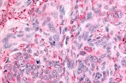 Anti-PTPRE antibody used in IHC (Paraffin sections) (IHC-P). GTX70951