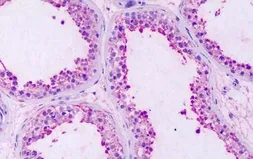Anti-GPRC5A antibody used in IHC (Paraffin sections) (IHC-P). GTX71141