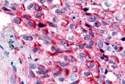 Anti-GPR32 antibody used in IHC (Paraffin sections) (IHC-P). GTX71225