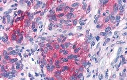 Anti-GPR44 antibody used in IHC (Paraffin sections) (IHC-P). GTX71385
