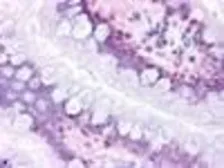 Anti-PTGDR antibody used in IHC (Paraffin sections) (IHC-P). GTX71677