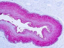 Anti-pan Cytokeratin antibody (ready-to-use) used in IHC (Paraffin sections) (IHC-P). GTX73375