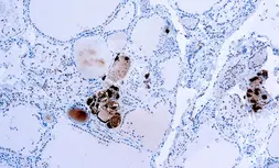 Anti-Calcitonin antibody used in IHC (Paraffin sections) (IHC-P). GTX73624