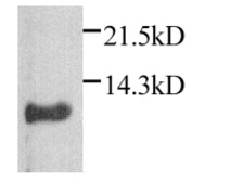 Anti-CXCL1 / GRO alpha antibody used in Western Blot (WB). GTX74108