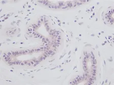 Anti-IL1 alpha antibody used in IHC (Paraffin sections) (IHC-P). GTX74157