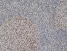 Anti-MCM2 antibody [CRCT2.1 (D1.9H5)] used in IHC (Paraffin sections) (IHC-P). GTX75459
