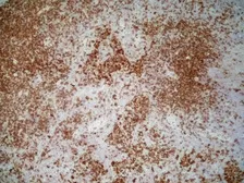 Anti-CD4 (Domain 1) antibody [OX-38] used in IHC (Frozen sections) (IHC-Fr). GTX76103
