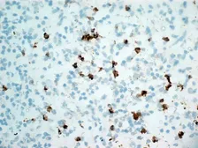 Anti-CD11b antibody [ICRF44] (Azide free) used in IHC (Frozen sections) (IHC-Fr). GTX76296