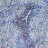 Anti-CD4 antibody [W3/25] (Biotin) used in IHC (Paraffin sections) (IHC-P). GTX76316