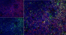 Anti-CD4 antibody [W3/25] used in IHC (Frozen sections) (IHC-Fr). GTX76318