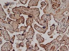 Anti-CD59 antibody [YTH53.1] used in IHC (Paraffin sections) (IHC-P). GTX76425