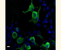 Anti-VSV-G tag antibody used in Immunocytochemistry/ Immunofluorescence (ICC/IF). GTX77441