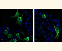 Anti-VSV-G tag antibody used in Immunocytochemistry/ Immunofluorescence (ICC/IF). GTX77446