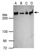 Anti-ATM antibody [2C1] (supernatant) used in Western Blot (WB). GTX77613