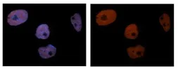 Anti-PCNA antibody, C-term used in Immunocytochemistry/ Immunofluorescence (ICC/IF). GTX77666