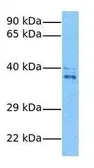 Anti-Cyclin G2 antibody, N-term used in Western Blot (WB). GTX77670