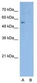 Anti-ERG antibody, Internal used in Western Blot (WB). GTX77743