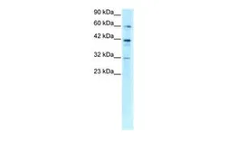 Anti-E2F4 antibody, C-term used in Western Blot (WB). GTX77806