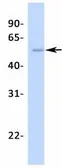 Anti-Steroidogenic Factor 1 antibody, Internal used in Western Blot (WB). GTX77813