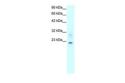 Anti-Claudin 9 antibody, C-term used in Western Blot (WB). GTX77838