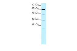 Anti-Embryonic Lung Protein antibody, N-term used in Western Blot (WB). GTX77854