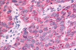 Anti-TAOK1 antibody used in IHC (Paraffin sections) (IHC-P). GTX78125