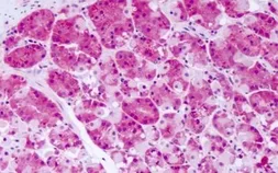 Anti-PKD2 antibody used in IHC (Paraffin sections) (IHC-P). GTX78137