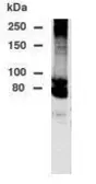 Anti-DPP10 antibody used in Western Blot (WB). GTX78173
