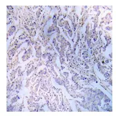 Anti-IRS1 antibody used in IHC (Paraffin sections) (IHC-P). GTX78916