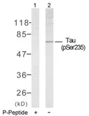 Anti-Tau (phospho Ser235) antibody used in Western Blot (WB). GTX78929