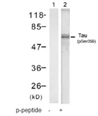Anti-Tau (phospho Ser356) antibody used in Western Blot (WB). GTX78931
