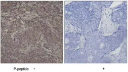 Anti-SMAD3 (phospho Ser425) antibody used in IHC (Paraffin sections) (IHC-P). GTX78942