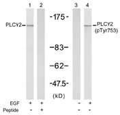 Anti-PLCG2 (phospho Tyr753) antibody used in Western Blot (WB). GTX78962
