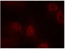 Anti-c-Myc (phospho Ser62) antibody used in Immunocytochemistry/ Immunofluorescence (ICC/IF). GTX79008