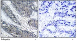 Anti-IRS1 (phospho Ser307) antibody used in IHC (Paraffin sections) (IHC-P). GTX79034