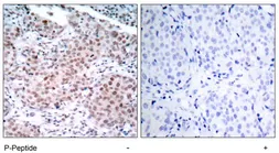 Anti-Estrogen Receptor alpha (phospho Ser104) antibody used in IHC (Paraffin sections) (IHC-P). GTX79081