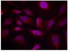 Anti-ATF2 (phospho Thr73) antibody used in Immunocytochemistry/ Immunofluorescence (ICC/IF). GTX79132