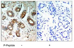 Anti-14-3-3 zeta (phospho Ser58) antibody used in IHC (Paraffin sections) (IHC-P). GTX79155
