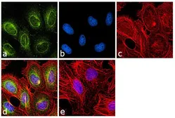 Anti-VRK1 antibody [1F6] used in Immunocytochemistry/ Immunofluorescence (ICC/IF). GTX79470