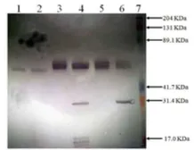 Anti-Prorenin/Renin antibody used in Western Blot (WB). GTX79677